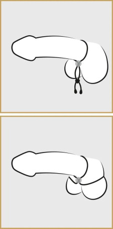 Лассо для пениса Double Cock Loop - Артикул 71563